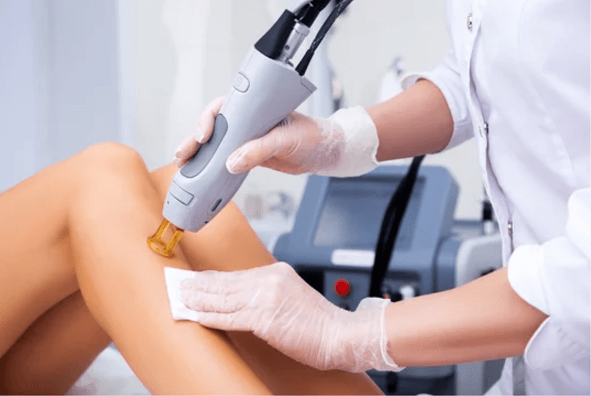 Laser Hair Removal