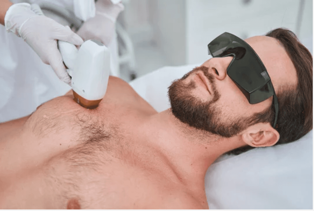 Chest Laser Hair Removal