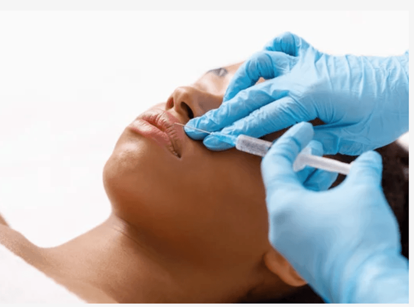 Lip Flip Botox