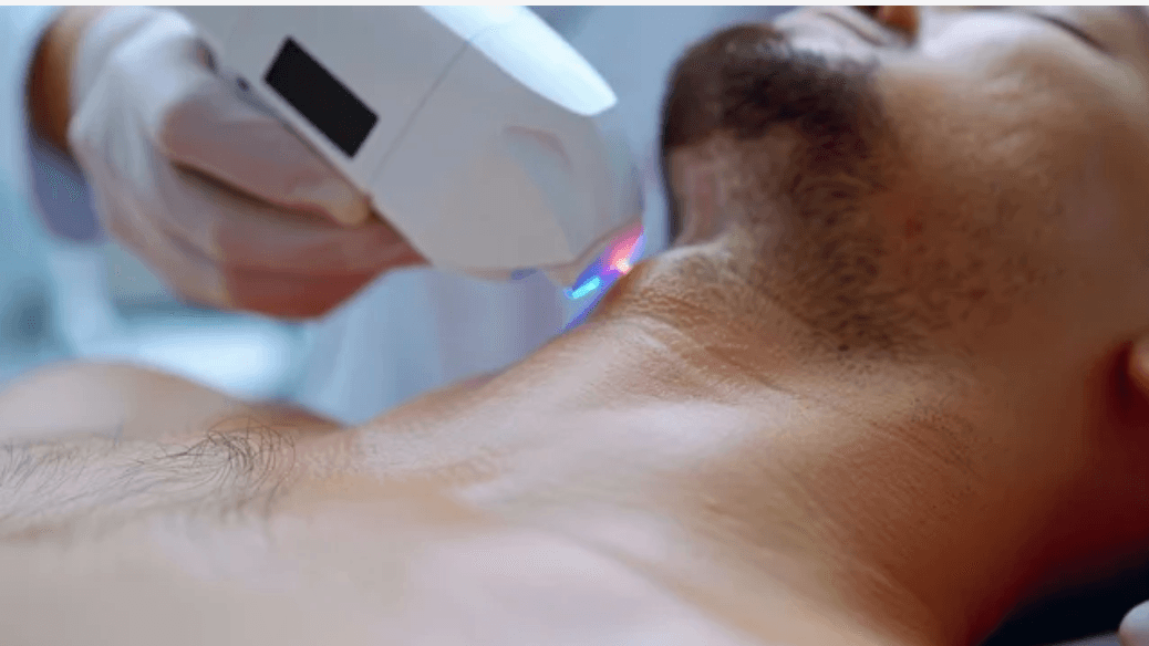Neck (Front or Back) Laser Hair Removal
