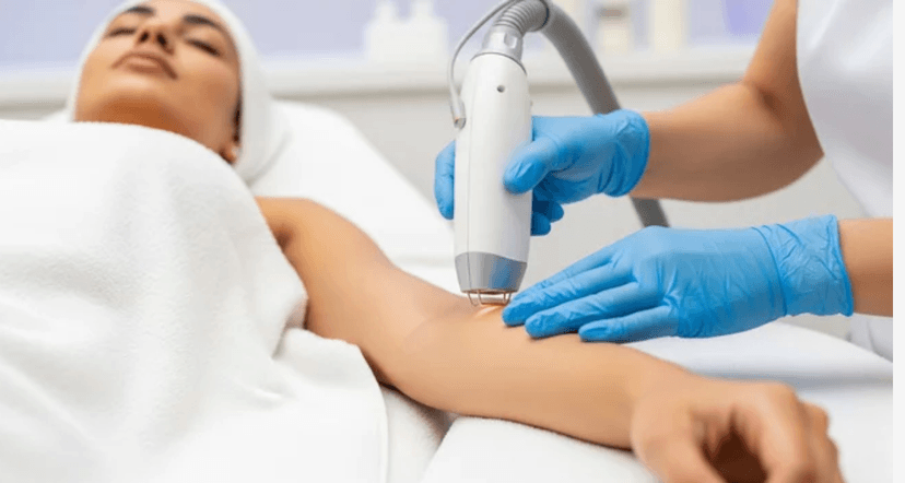 Arms (Full) Laser Hair Removal