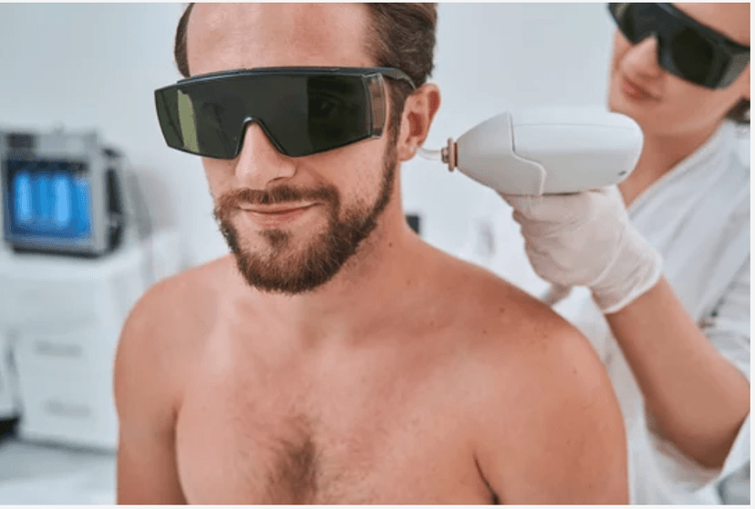 Ears Laser Hair Removal