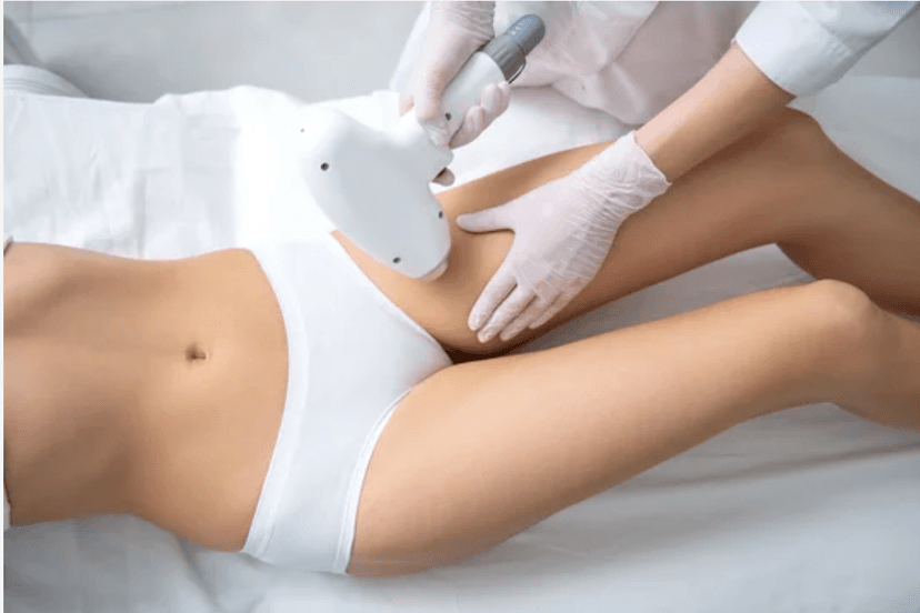 Legs (Lower or Thighs) Laser Hair Removal