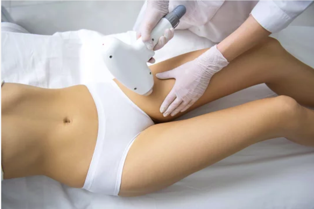 Full Legs Laser Hair Removal